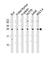 TIGIT Antibody in Western Blot (WB)