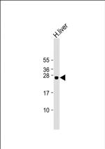 GSTA5 Antibody in Western Blot (WB)