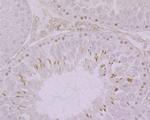 Histone H2A.X Antibody in Immunohistochemistry (Paraffin) (IHC (P))