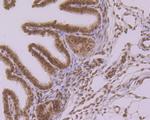 Histone H2A.X Antibody in Immunohistochemistry (Paraffin) (IHC (P))