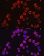 TEC Antibody in Immunocytochemistry (ICC/IF)