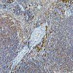 TEC Antibody in Immunohistochemistry (Paraffin) (IHC (P))