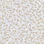 Lamin A/C Antibody in Immunohistochemistry (Paraffin) (IHC (P))