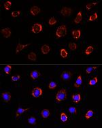 SLC25A1 Antibody in Immunocytochemistry (ICC/IF)