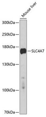 SLC4A7 Antibody in Western Blot (WB)