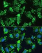 ENO1 Antibody in Immunocytochemistry (ICC/IF)