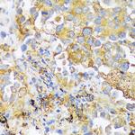 ZDHHC18 Antibody in Immunohistochemistry (Paraffin) (IHC (P))