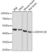 ZDHHC18 Antibody in Western Blot (WB)