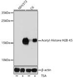 H2BK5ac Antibody in Western Blot (WB)