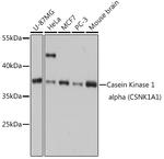 CK1 alpha Antibody in Western Blot (WB)