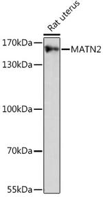 MATN2 Antibody in Western Blot (WB)