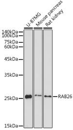 RAB26 Antibody in Western Blot (WB)