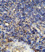 CD45 Antibody in Immunohistochemistry (Paraffin) (IHC (P))