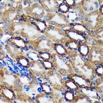 TMX2 Antibody in Immunohistochemistry (Paraffin) (IHC (P))