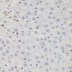 AKAP8 Antibody in Immunohistochemistry (Paraffin) (IHC (P))