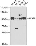 AKAP8 Antibody in Western Blot (WB)