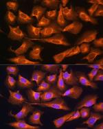 RPS28 Antibody in Immunocytochemistry (ICC/IF)