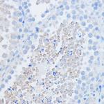 RALGDS Antibody in Immunohistochemistry (Paraffin) (IHC (P))