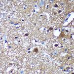 TSN Antibody in Immunohistochemistry (Paraffin) (IHC (P))