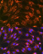 VAMP7 Antibody in Immunocytochemistry (ICC/IF)