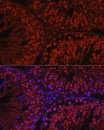 C1orf146 Antibody in Immunohistochemistry (Paraffin) (IHC (P))