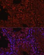 C1orf146 Antibody in Immunohistochemistry (Paraffin) (IHC (P))