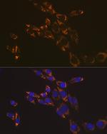 RNF126 Antibody in Immunocytochemistry (ICC/IF)