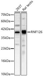 RNF126 Antibody in Western Blot (WB)