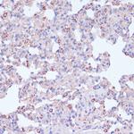 CD18 Antibody in Immunohistochemistry (Paraffin) (IHC (P))