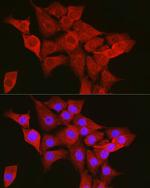 TTK Antibody in Immunocytochemistry (ICC/IF)