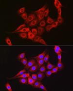 TTK Antibody in Immunocytochemistry (ICC/IF)