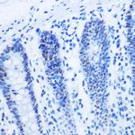 H3R8me2a Antibody in Immunohistochemistry (Paraffin) (IHC (P))