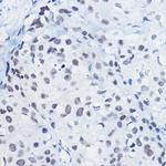 H4R3me1 Antibody in Immunohistochemistry (Paraffin) (IHC (P))