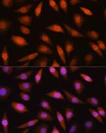 LIMK2 Antibody in Immunocytochemistry (ICC/IF)