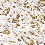 MAGE1 Antibody in Immunohistochemistry (Paraffin) (IHC (P))