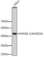 MAGE1 Antibody in Western Blot (WB)