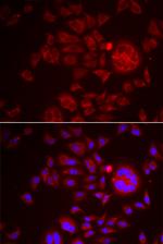 HAI-1 Antibody in Immunocytochemistry (ICC/IF)