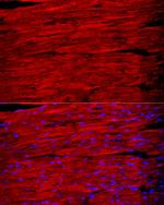 Myosin heavy chain 1 Antibody in Immunocytochemistry (ICC/IF)