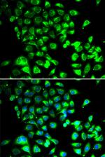 SSBP1 Antibody in Immunocytochemistry (ICC/IF)