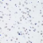 H3K64me3 Antibody in Immunohistochemistry (Paraffin) (IHC (P))