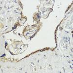 HACE1 Antibody in Immunohistochemistry (Paraffin) (IHC (P))