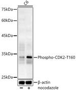 Phospho-CDK2 (Thr160) Antibody in Western Blot (WB)