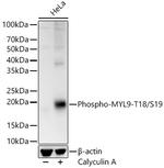 Phospho-MYL9 (Thr18, Ser19) Antibody in Western Blot (WB)