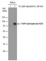 Phospho-YAP1 (Ser127) Antibody in Western Blot (WB)