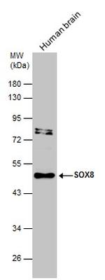 SOX8 Antibody in Western Blot (WB)