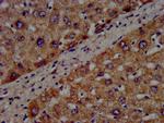 CYP8B1 Antibody in Immunohistochemistry (Paraffin) (IHC (P))