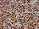 CYP8B1 Antibody in Immunohistochemistry (Paraffin) (IHC (P))