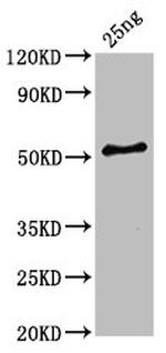 Clostridium botulinum HA-33 Antibody in Western Blot (WB)