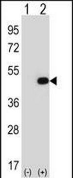 eIF2b gamma Antibody in Western Blot (WB)