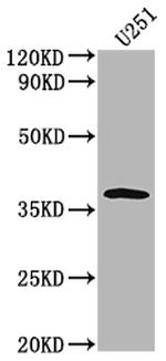 OR6B3 Antibody in Western Blot (WB)